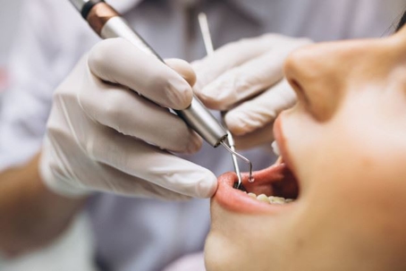 dentist fixing patients teeth